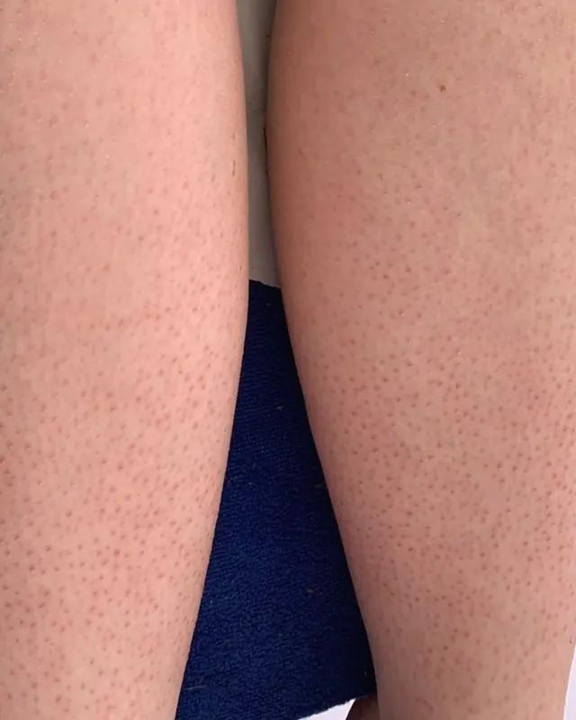 Smooth legs after a waxing appointment
