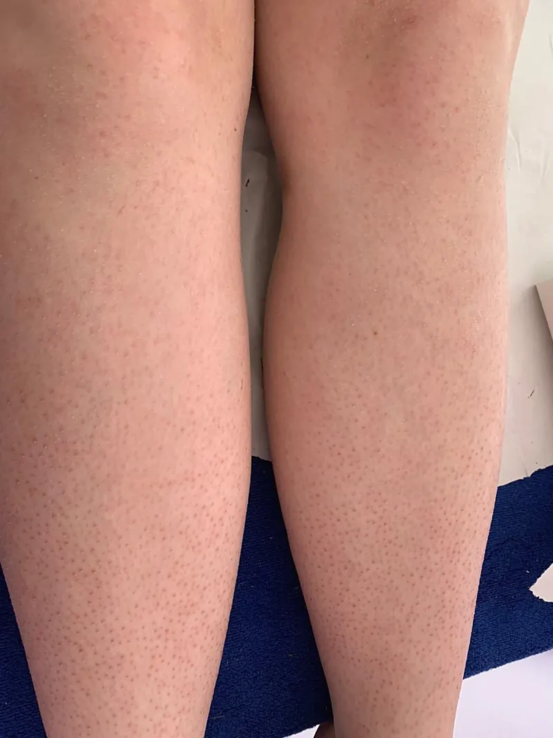 Smooth legs after a waxing appointment