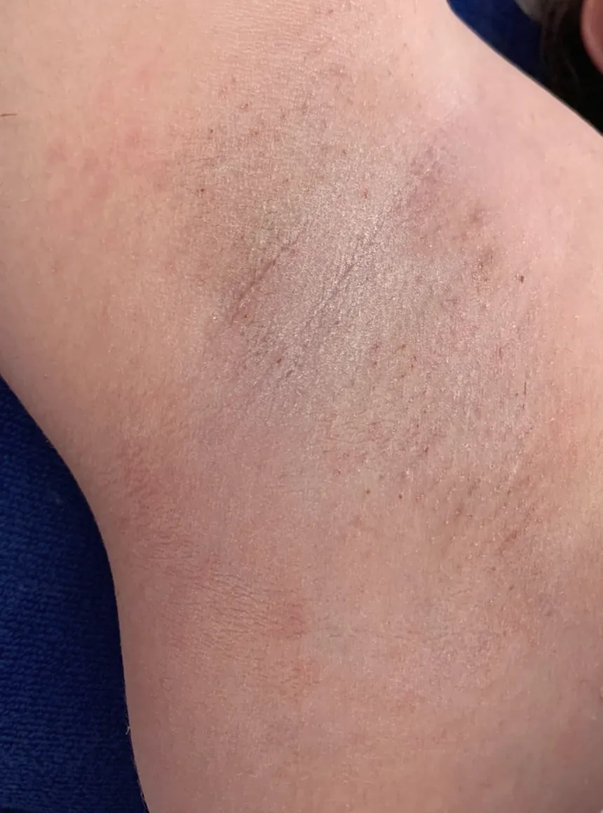 Soft close-up of smooth skin, in black and white